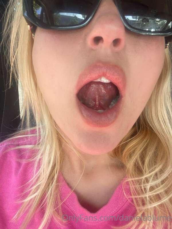 Tongue cuted from sucking