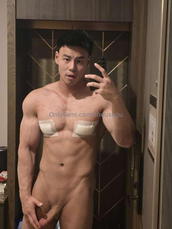 Finally did the gyno surgery 🥹