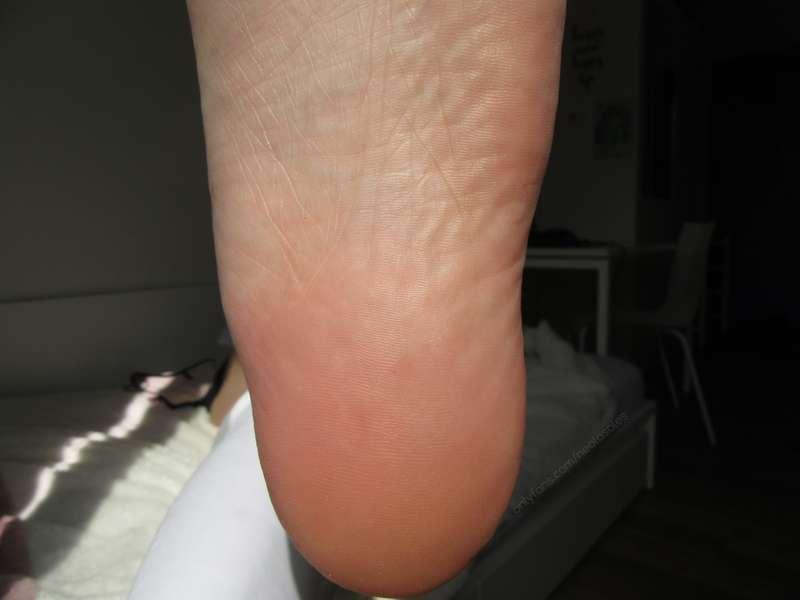 neolasoles image #4