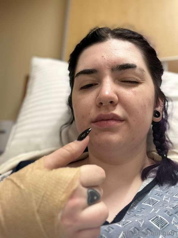 A really hot drugged up photo of me after getting out of sur..