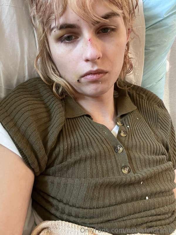 another stupid day in my shitty car accident life