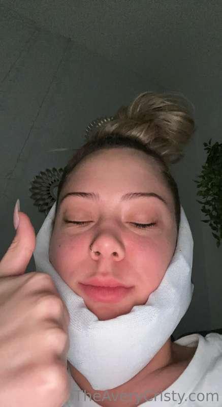 Am alive 👍🏼 wisdom teeth removal successful 🤣