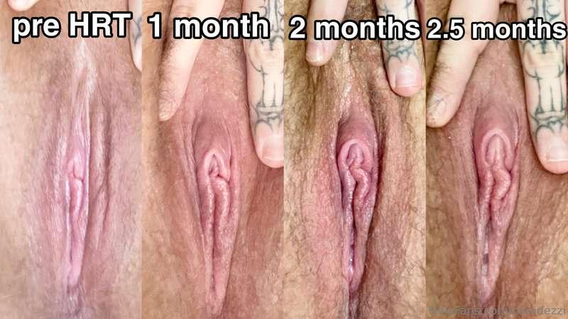 a lil tdick timeline for you! 🥰🏳️‍⚧️

I’m approaching 3 mont..