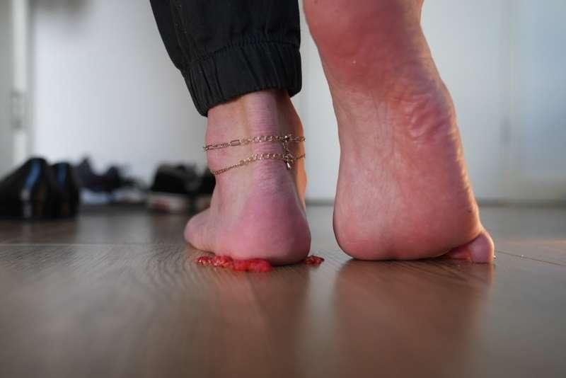 Crushed by Heel