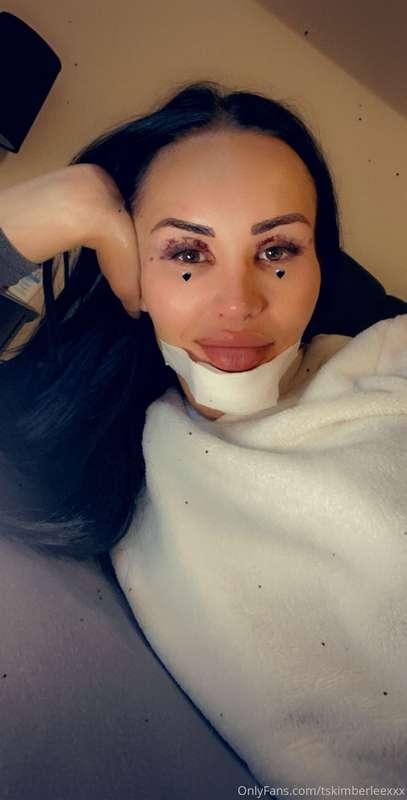 My surgery went well ❤️❤️❤️ Did you like my last video ?