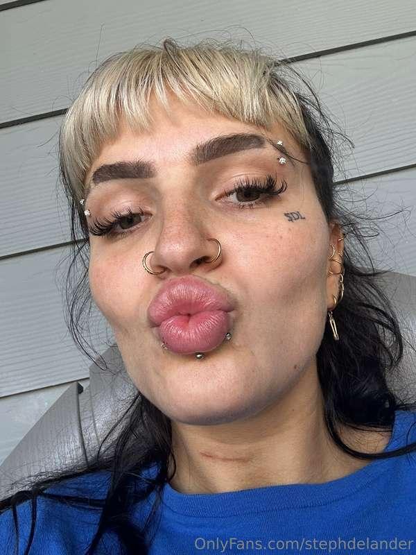 I got lip injections yesterday. What do u think ??? 👄 💋 