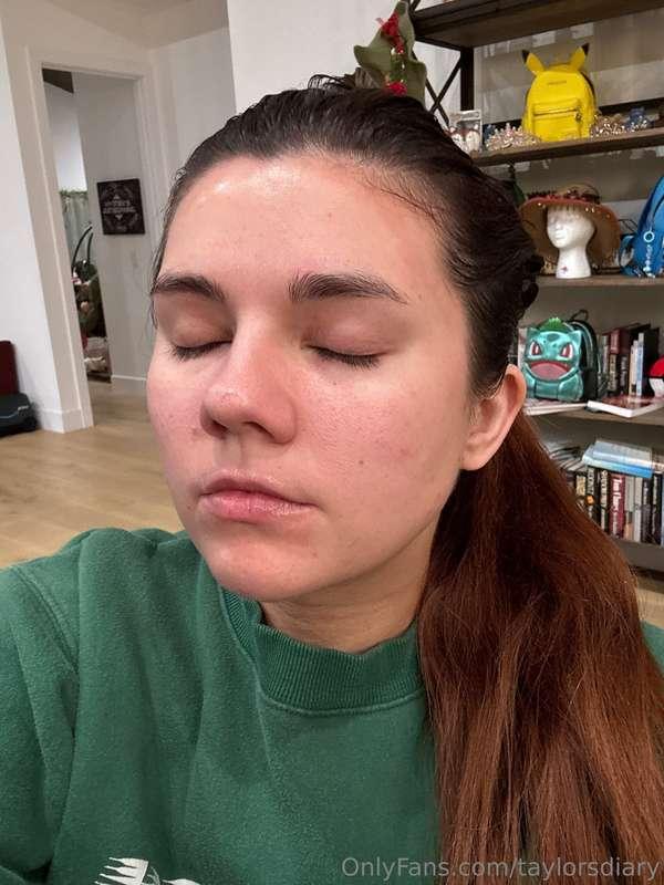 It’s now day three off the creme stair roids ( spelled incor..