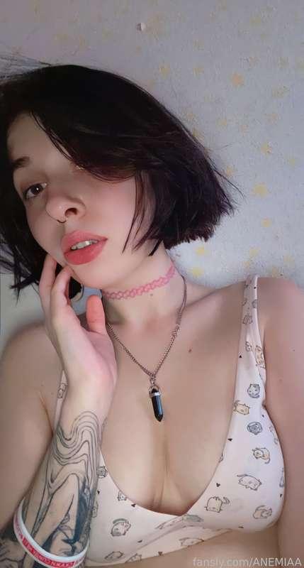 anemiaa image #2