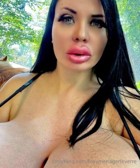How do they look? Can't close my mouth yet. I got one 18 mon..