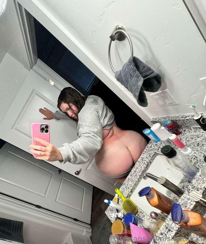 This sunburn is crazy lol