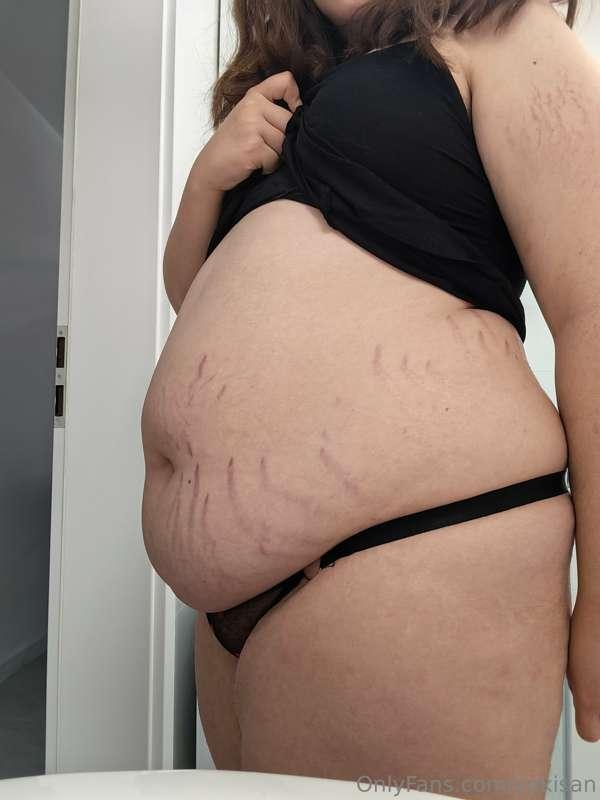 A lot of stretch marks 😰