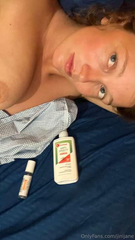 I was so sick the doctor thought I might have dengue but I b..