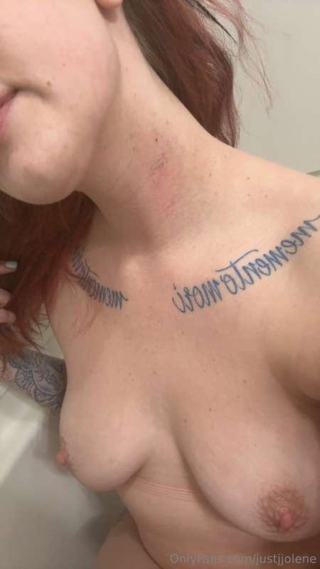 This is sadly not a hickey but instead it is from getting ch..