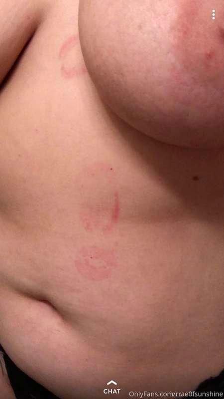 rrae0fsunshine image #2