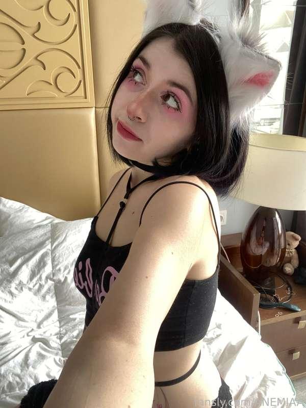 anemiaa image #17