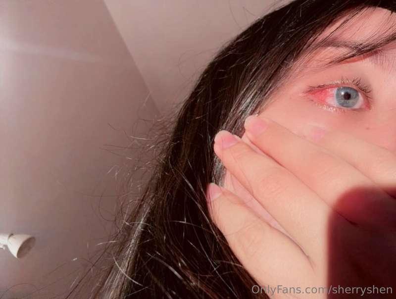Something got into my eye and it’s very irritated right now...