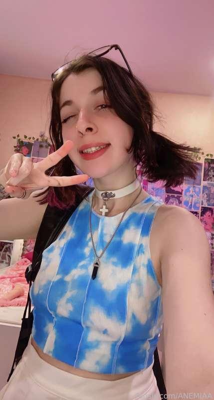 anemiaa image #1