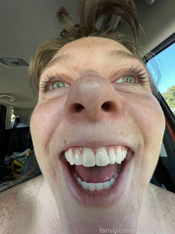 freckledspirit image #8