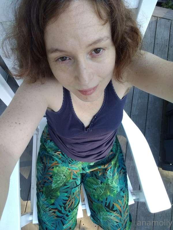 anamolly image #3