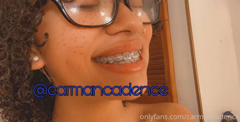 Am I your favorite brace face?😋

Https://OnlyFans.com/carman..