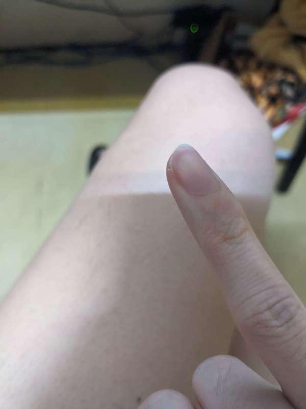 指甲長刺