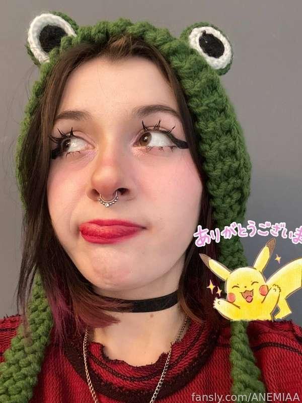 anemiaa image #2