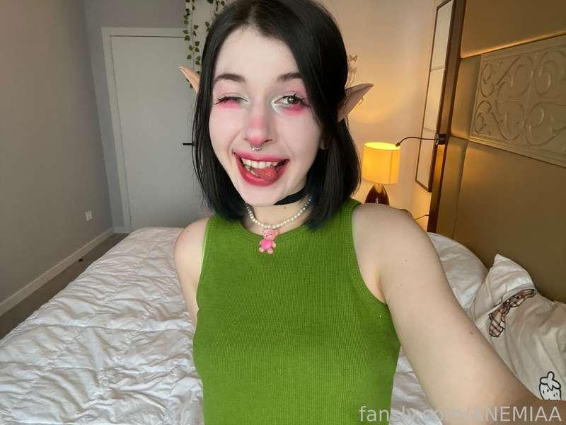 anemiaa image #4