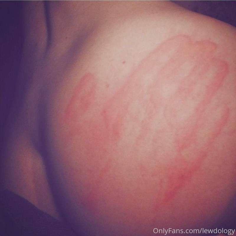 art of the body, this hurt!!