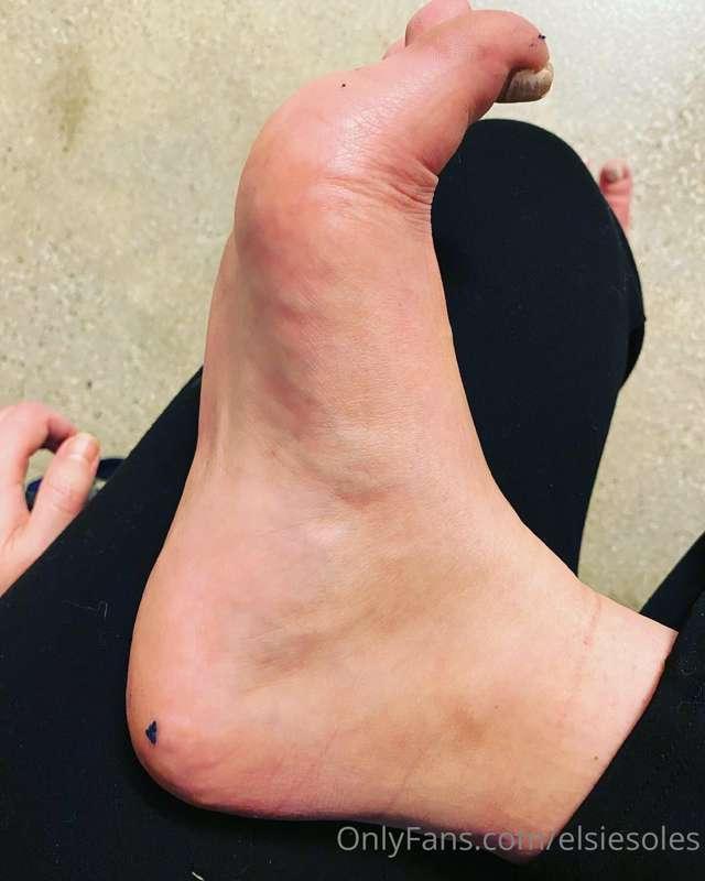 LOL lots of toe jam and sock fuzz today! When I tell you I w..
