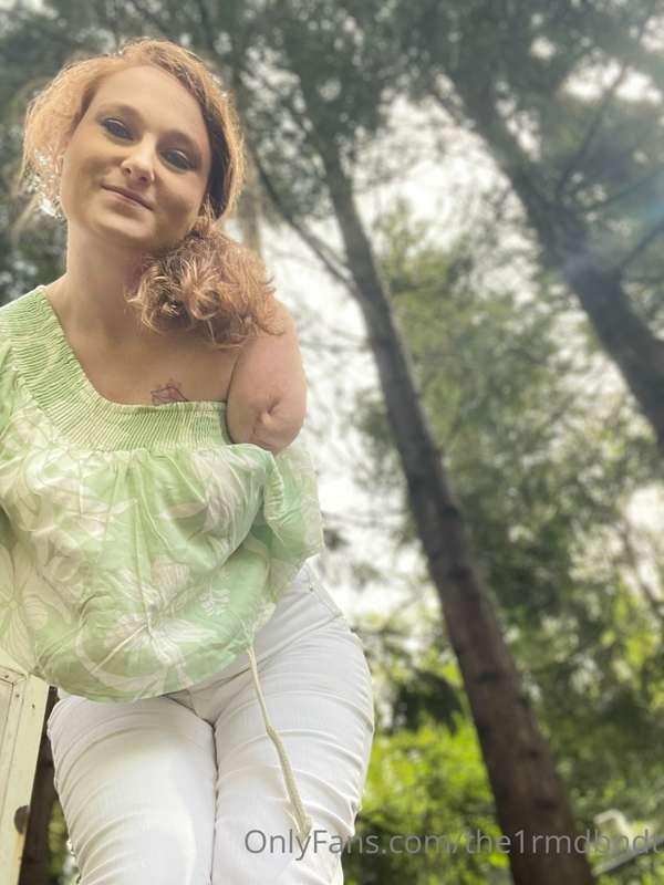 POV: You fainted in the park and you are opening your eyes t..