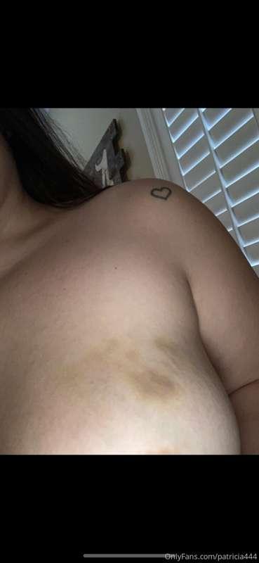 How does everyone feel about hickeys?