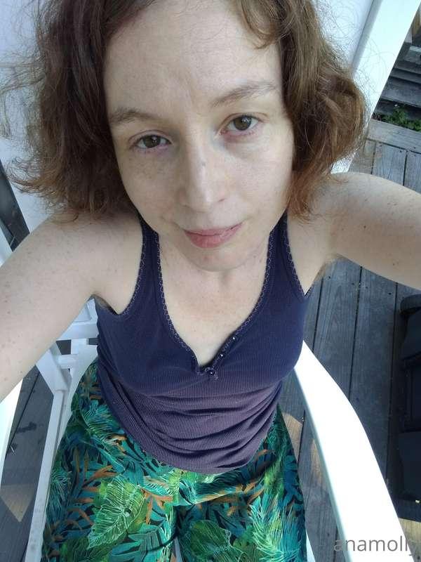 anamolly image #4