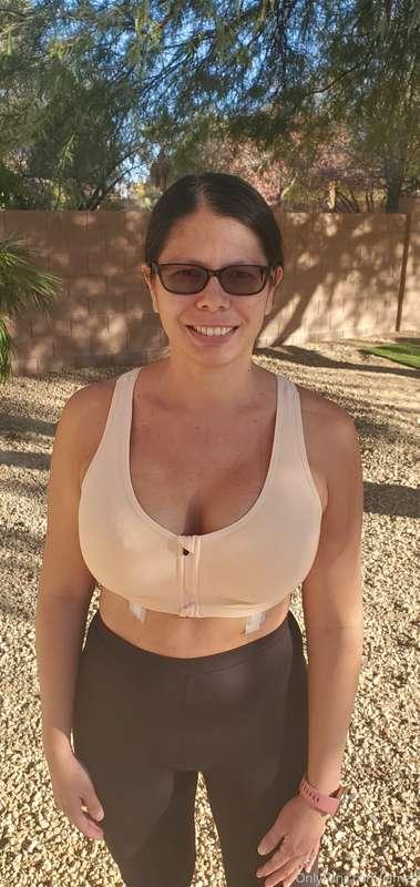 Less than 24 hours after surgery. Turns out one of the impla..