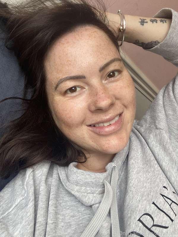 Look at those freckles.... 🥴