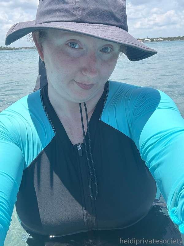 Florida sun can be fun but sunburn is a thing I have to deal..