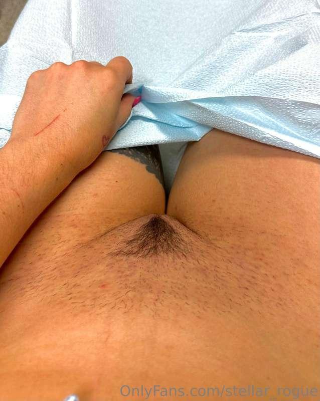 Laser hair removal on Mrs. Siren! ☺️