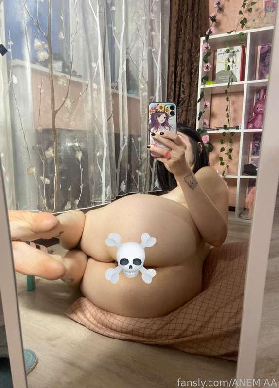 anemiaa image #2