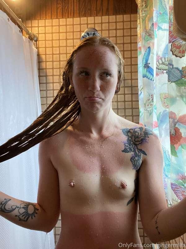 look how sunburnt i got LOL swipe to see my invisible bikini..