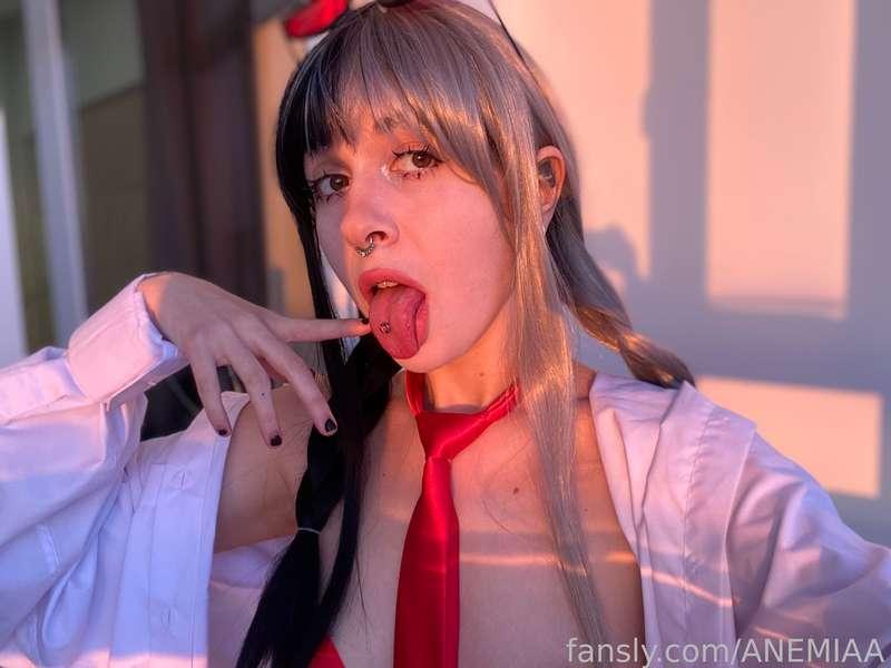 anemiaa image #2