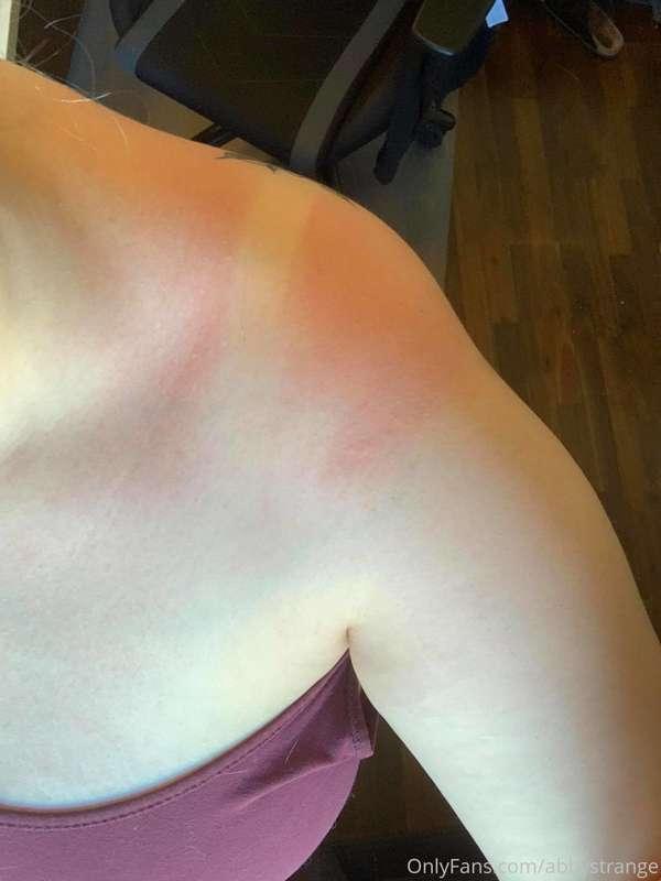 I went outside today... I guess I shouldn't do that.