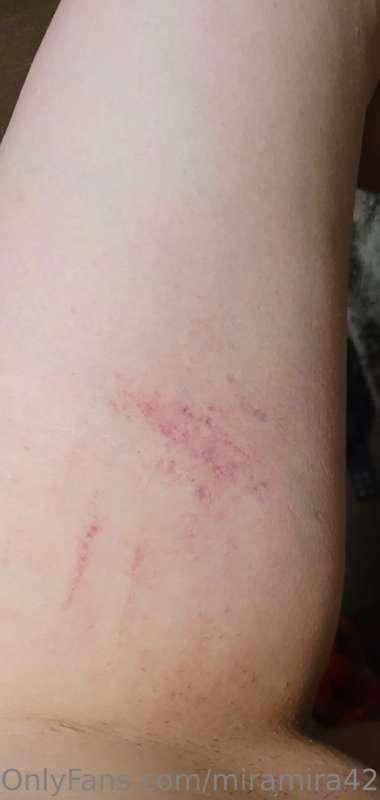 Daddy left me some lovely marks on my ass and thighs last ni..