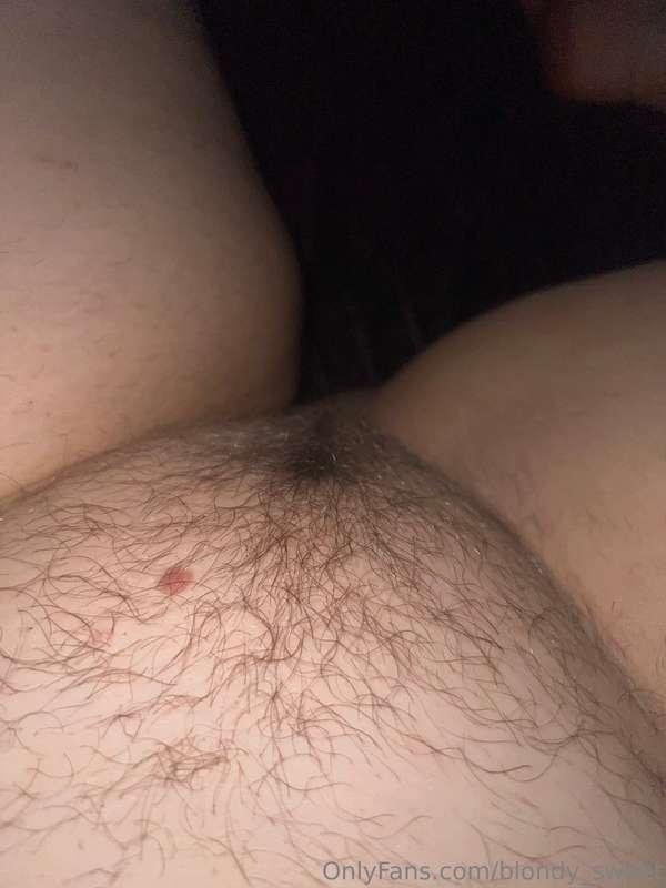 Hairy 1 month