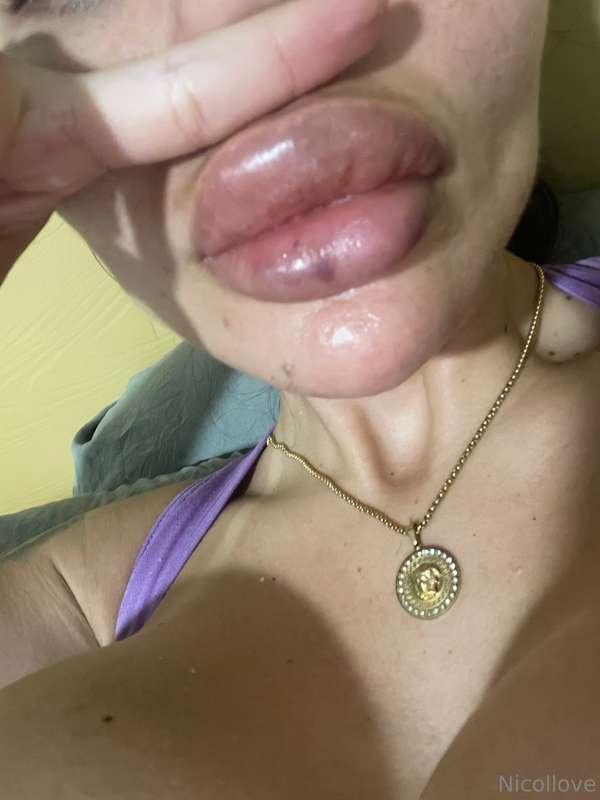 New lips New tan😏😏😏