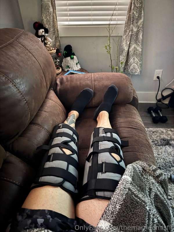 It’s not easy to take pics being all jacked up but surgery t..