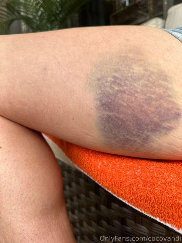 What had happened was….. 
it was my fault 
But I got bucked ..