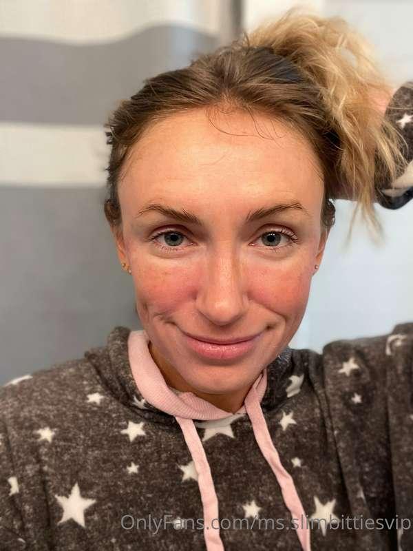 Update on my face from the chemical peel: yesterday my face ..