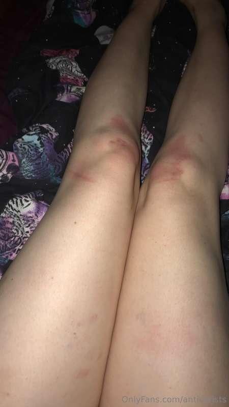 need to get off my knees…
