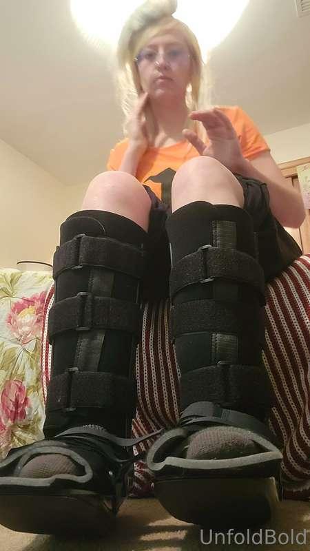 So a dog bit me in my legs. The owner said he's just "playin..