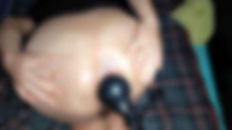 analkingx image #0