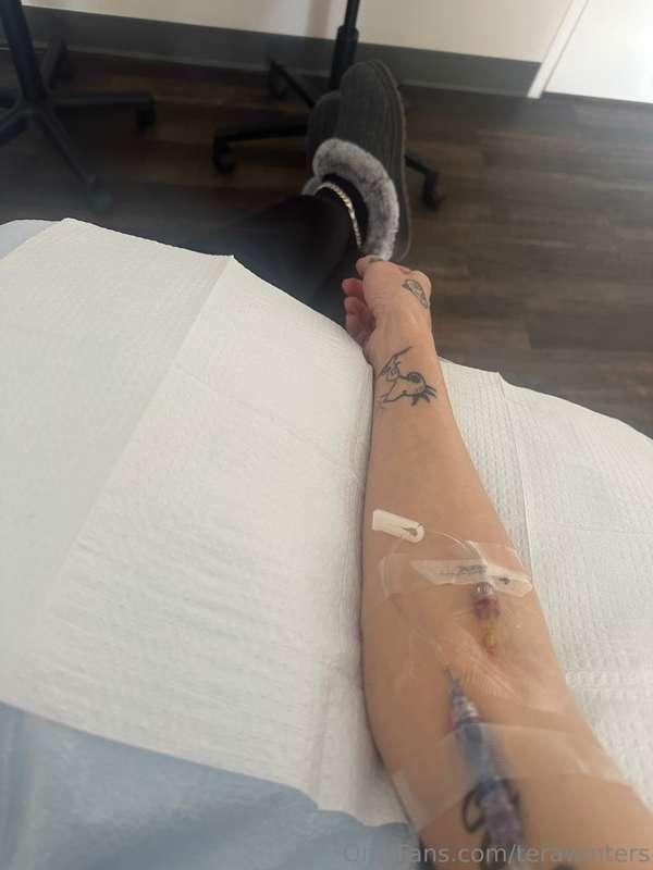 4th treatment!! 🥳 half way there